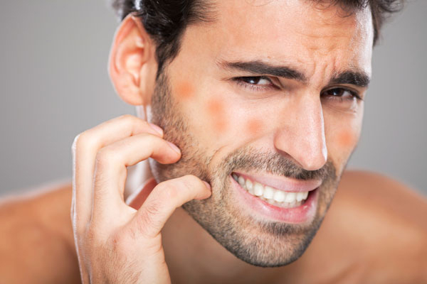 man skin