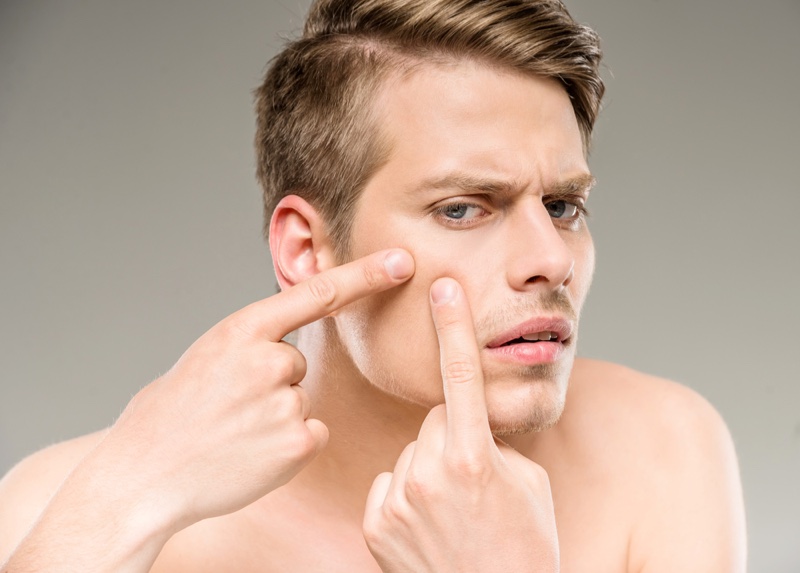 man acne