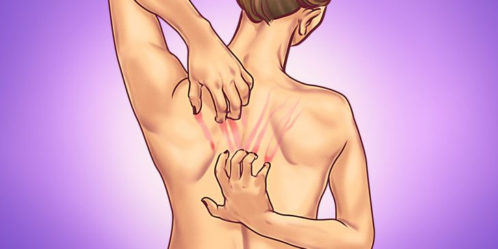 Itchy skin