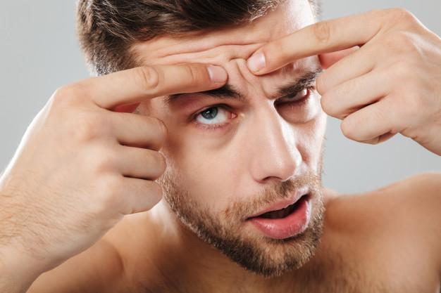 a man squeezing pimple 
