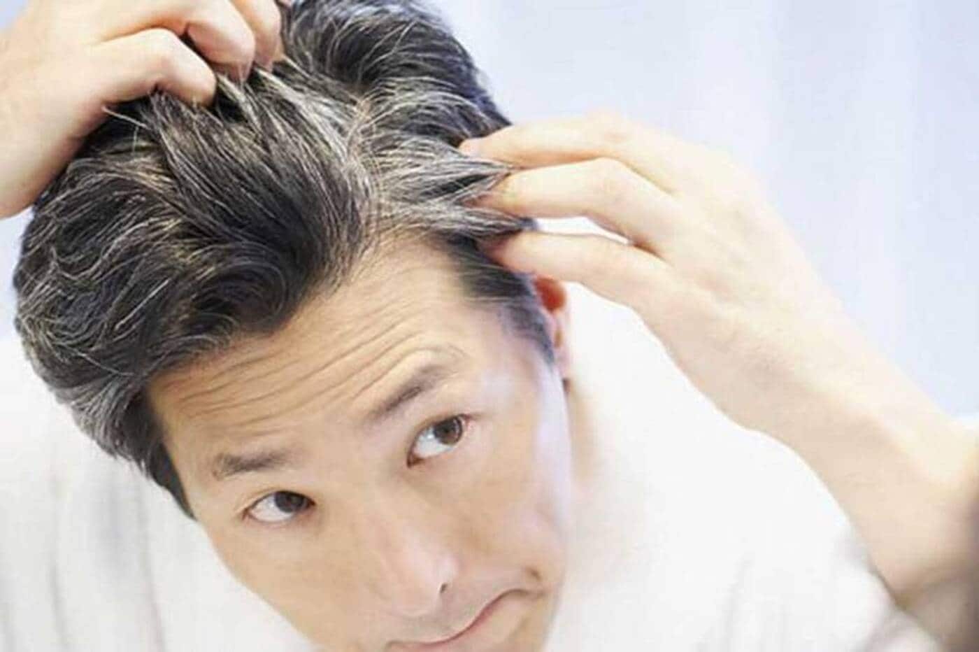 white hair problem in young age