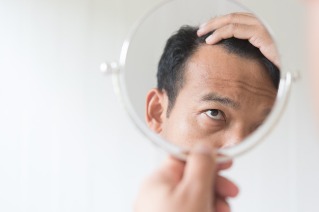 men-are-worried-about-hair-loss