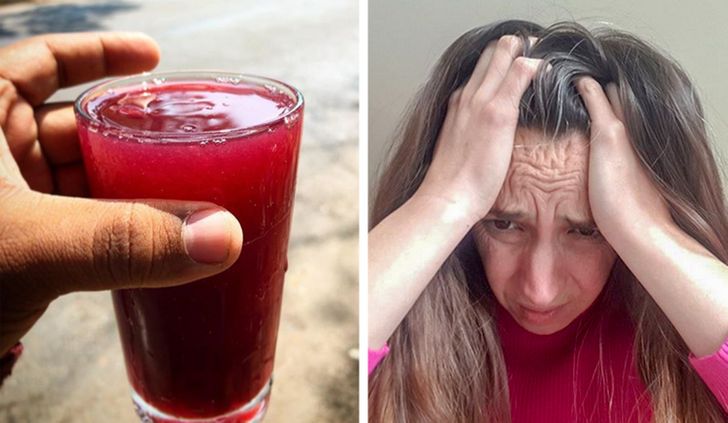 Try Grape Juice to heal your migraines