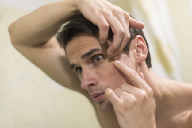 man popping a pimple