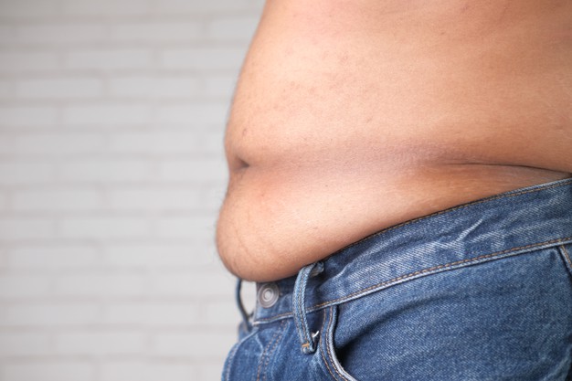 man with excessive belly fat