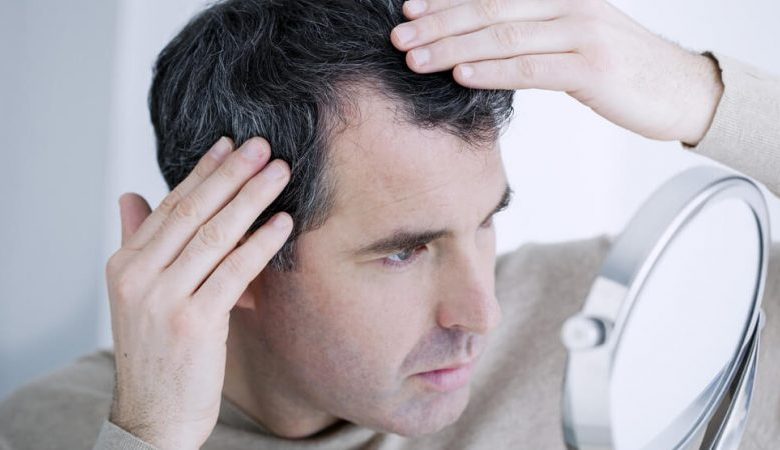 man turning hair white