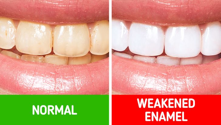 Dental care tips for men