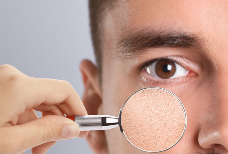 man with sensitive skin