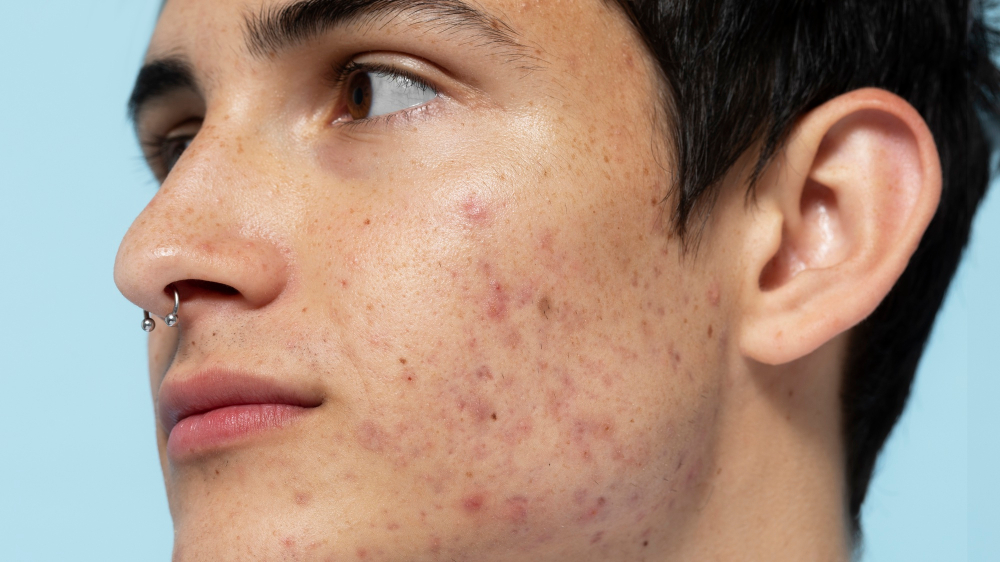 man skin