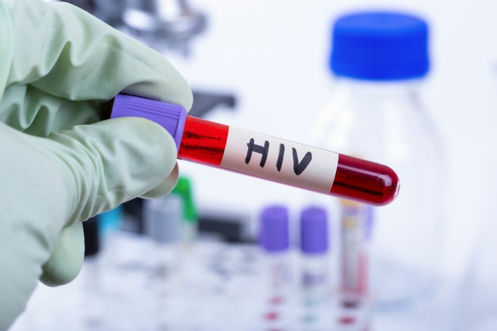 HIV