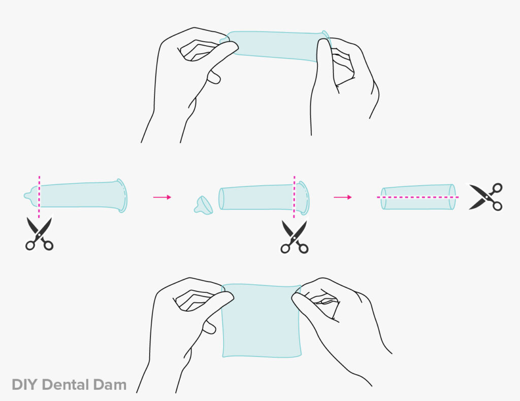 Dental Dam