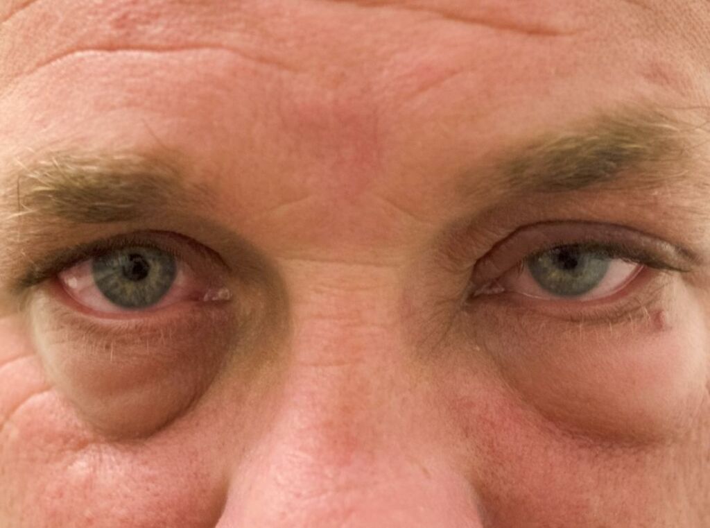 Eyes