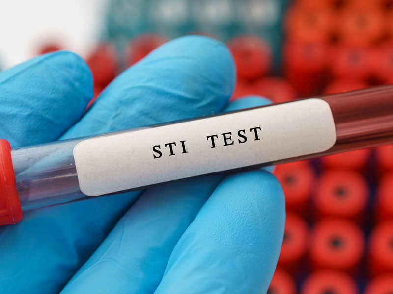 stis test
