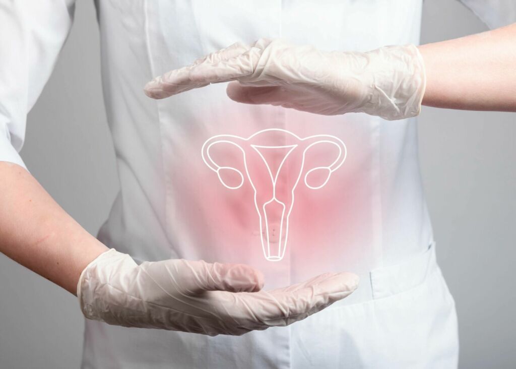 Cervical Cancer 