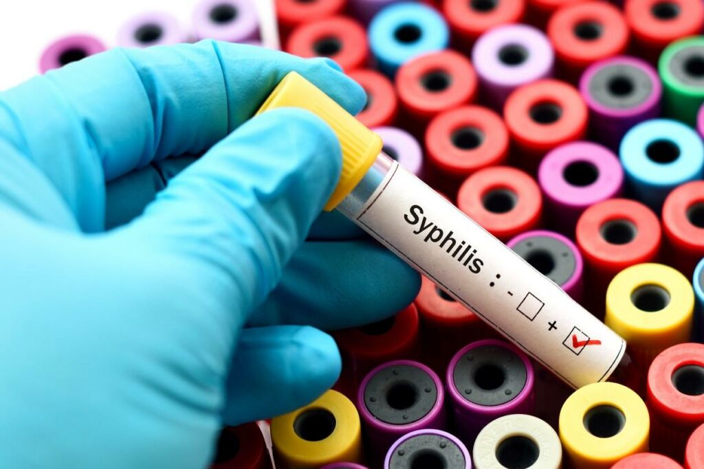 sexually transmitted infections