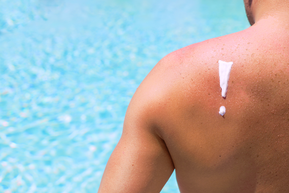  Sun Damage 