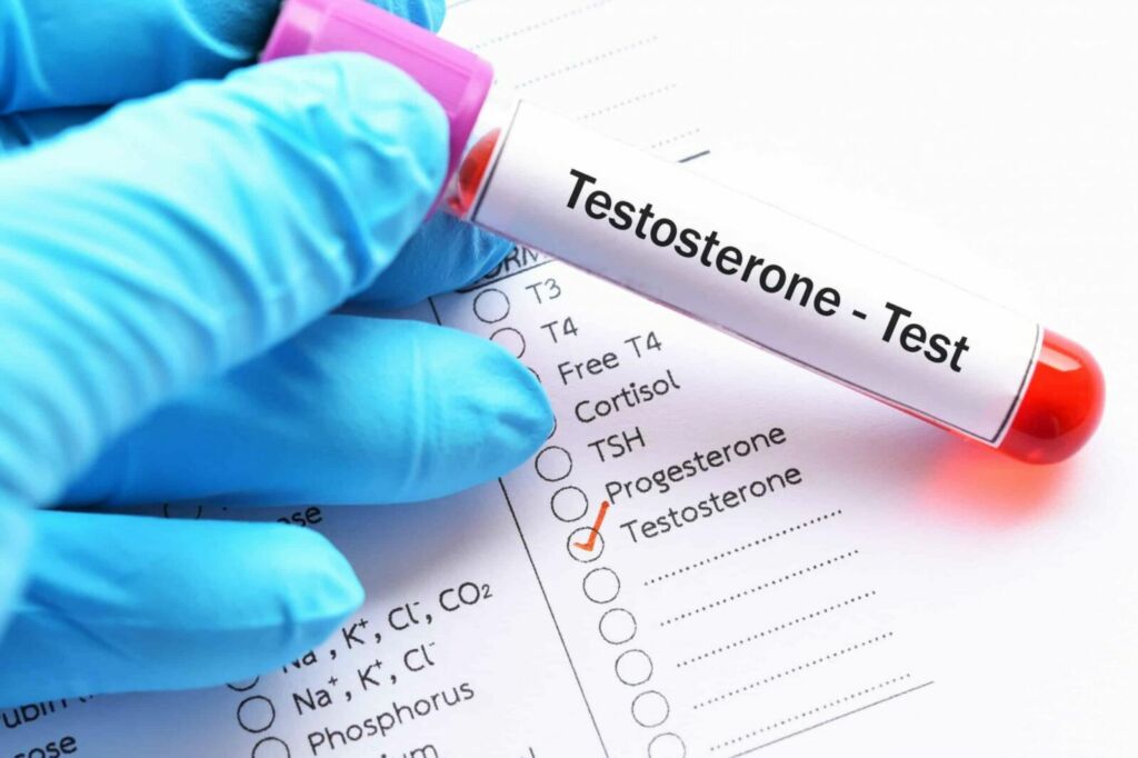 Testosterone