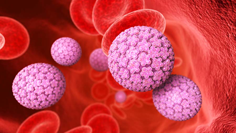 genital warts 