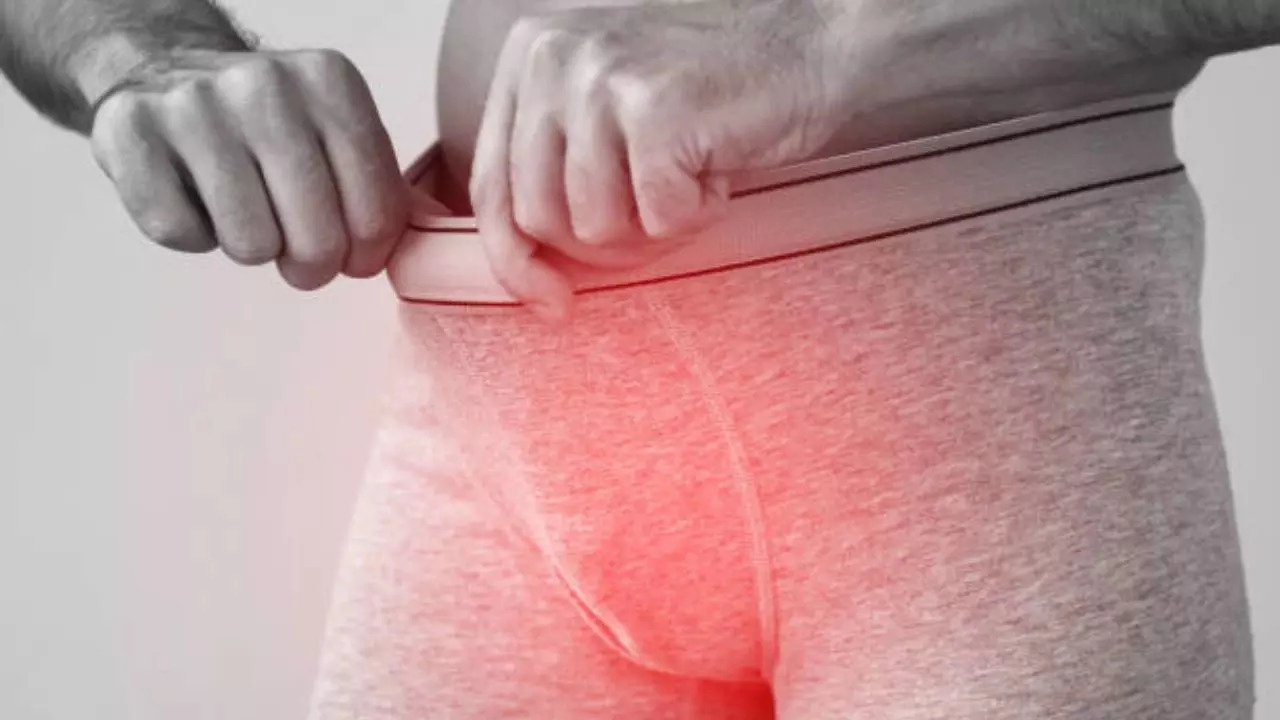penile cancer