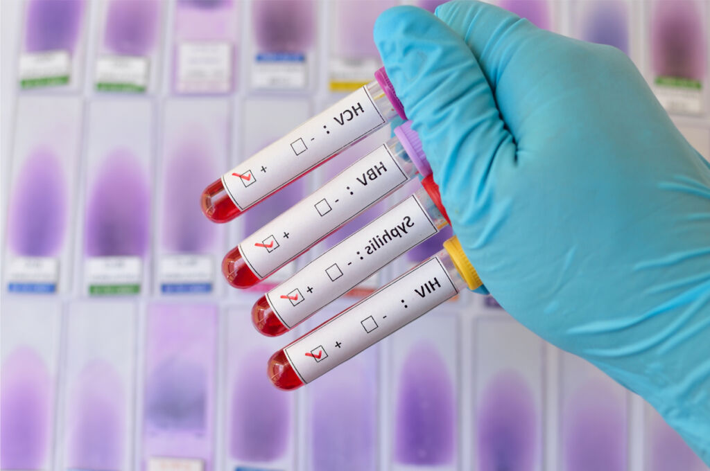 sexually transmitted infections