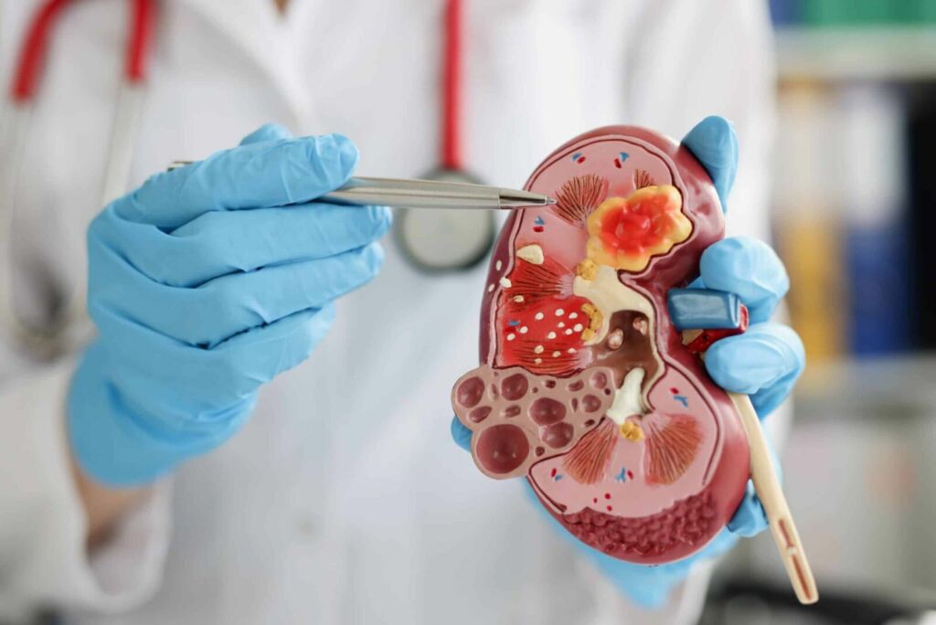 Kidney Health 