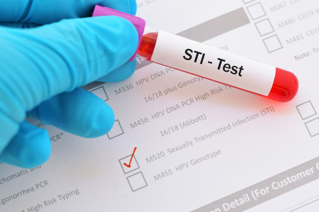 Get tested regularly