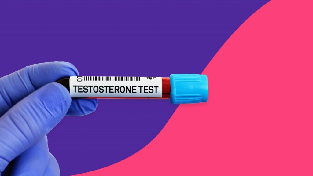 Testosterone 