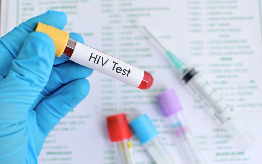 HIV Test 